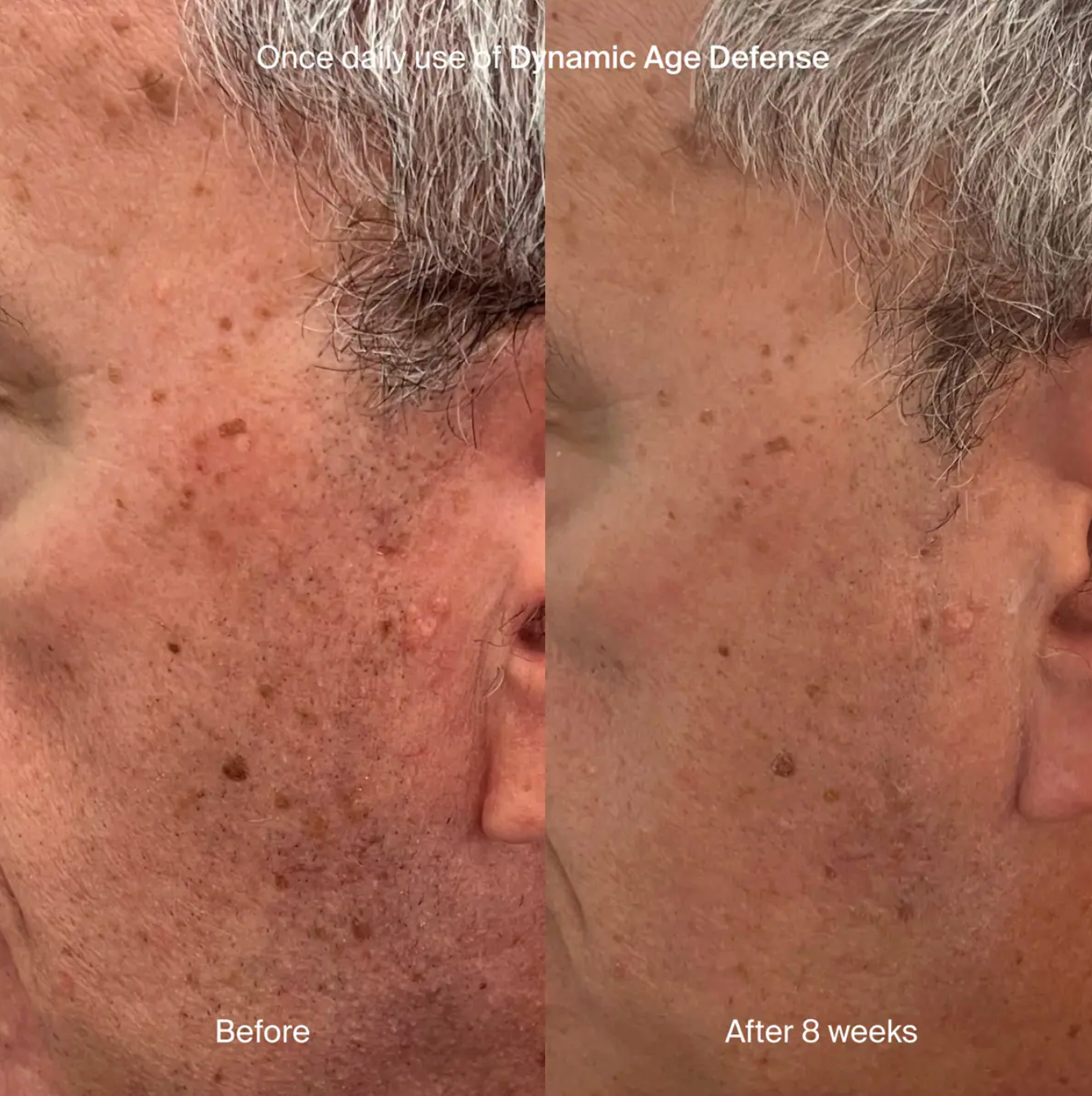 Pavise Dynamic Age Defense Refill