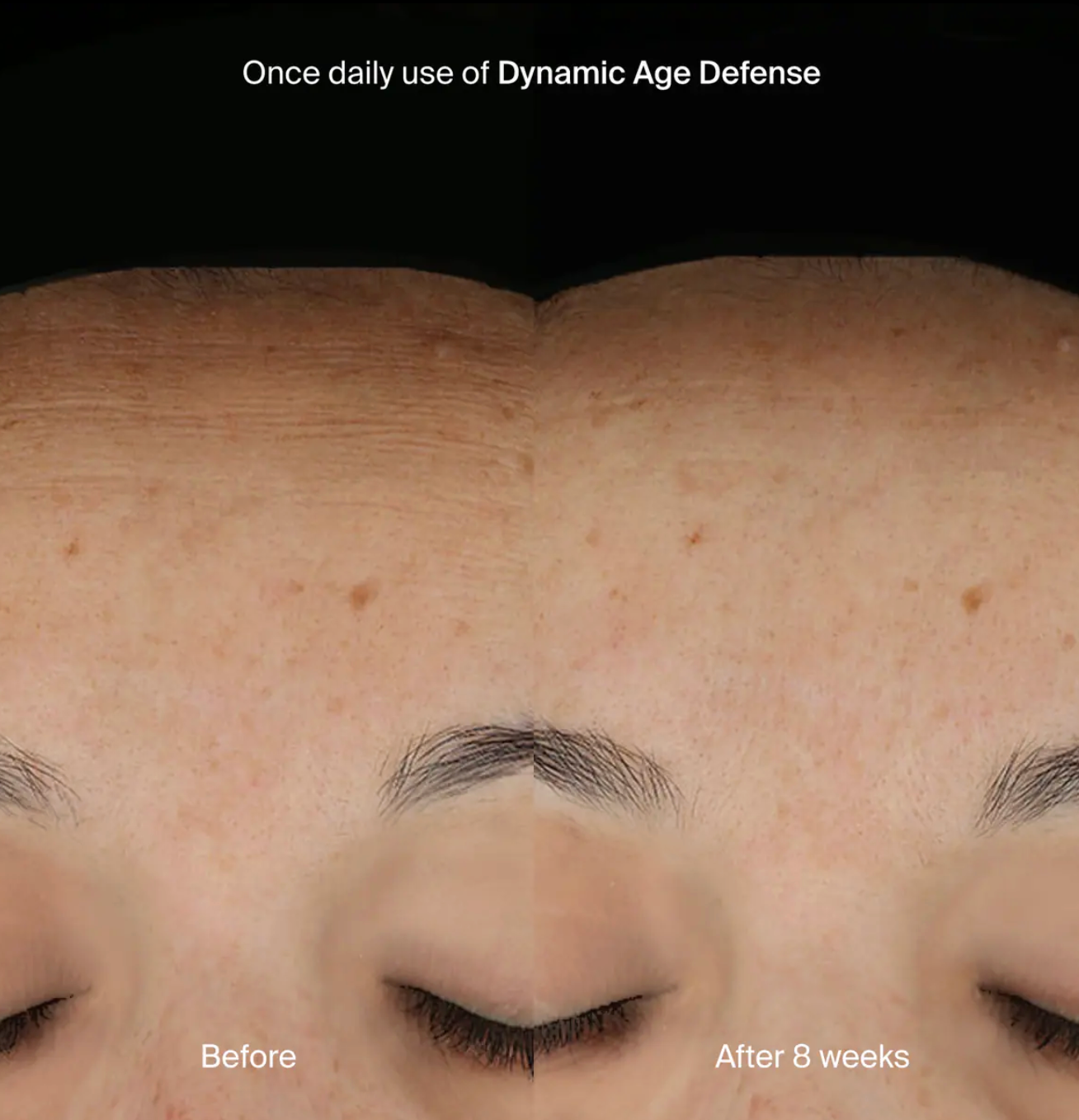 Pavise Dynamic Age Defense Refill